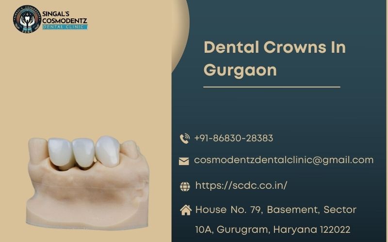 Dental Crowns in Gurgaon: A Solution for Damaged Teeth